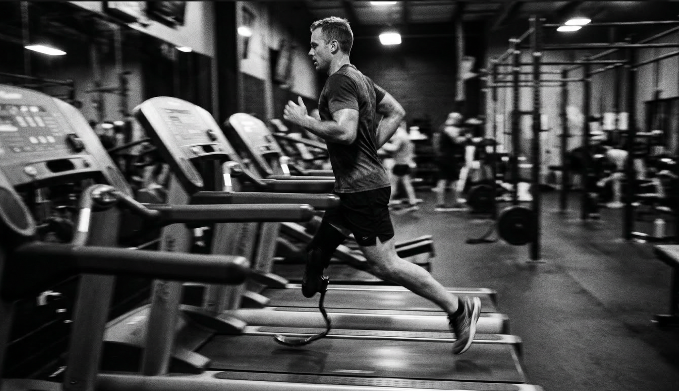 Overlay TT 2.0 shown as a prosthetic fit solution available in 12 sizes for transtibial amputees.