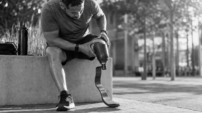 Lower limb amputee adjusting a running blade prosthesis, representing prosthetic socket fit, limb volume variation, heat, and comfort challenges.