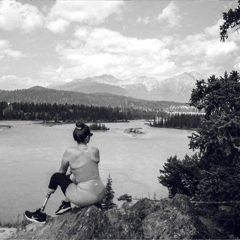 We Want to Hear From You: Feedback From the Lower Limb Amputee Community